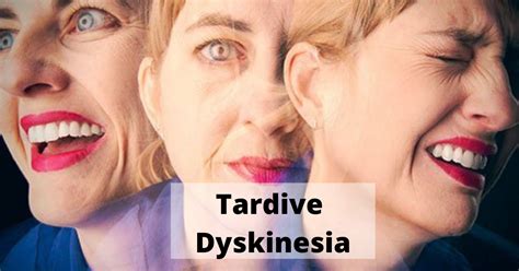 conditions similar to tardive dyskinesia